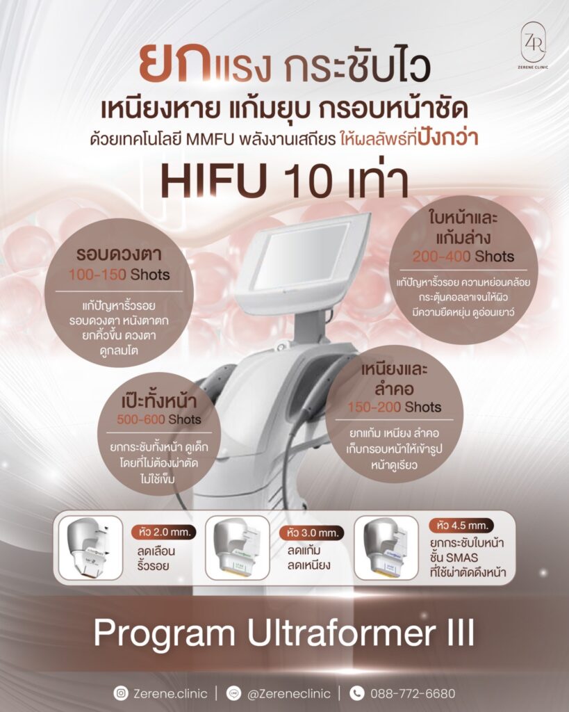 อัลตร้าฟอร์เมอร์ Ultraformer III ดียังไง? ดีกว่าHIFUมั้ย? ซีรีนคลินิก ซีรีนคลินิก BTS บางหว้า MRT บางไผ่