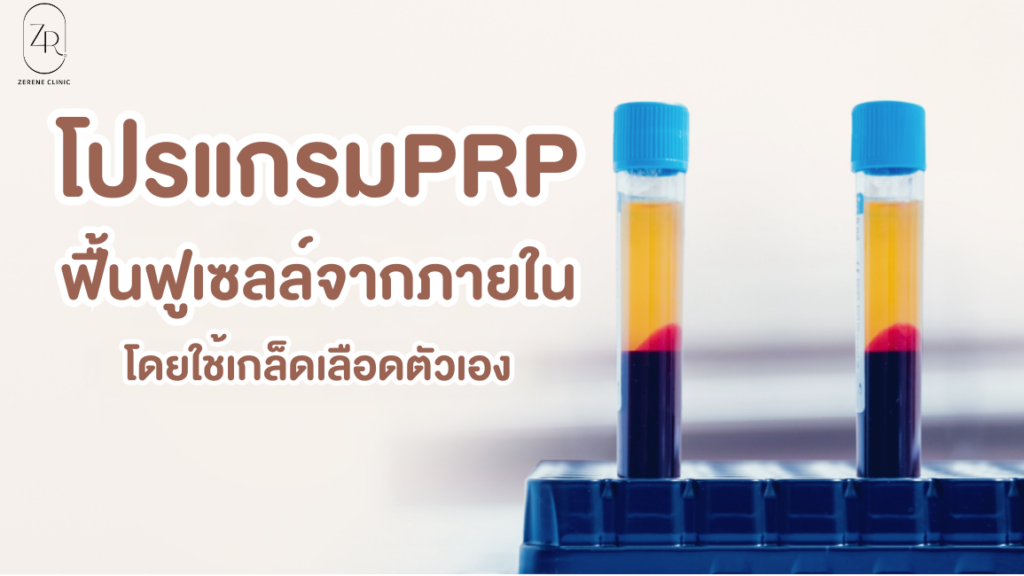 การทำ PRP (Platelet Rich Plasma) เป็นนวัตกรรมที่นิยมอย่างมาก เพราะสามารถนำมาใช้ทางการแพทย์ได้หลากหลาย อาทิ ในวิทยาศาสตร์การกีฬา การฉีด PRP จะช่วยให้อาการบาดเจ็บของนักกีฬาหายเร็วขึ้น แพทย์ด้านกระดูกและข้อ ใช้ PRP ช่วยให้กระดูกติดเร็วขึ้น แม้กระทั่งแพทย์ผิวหนังก็ยังใช้ PRP เพื่อให้ผิวหน้ากระจ่างใส กระชับรูขุมขน กระตุ้นการสร้างเนื้อเยื่อและคอลลาเจน รวมไปถึงการฉีดบริเวณศีรษะเพื่อบรรเทาอาการผมร่วง ผมบาง เป็นต้น ซีรีน คลินิก